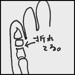 ���܂̓^���̃T���l�C���摜